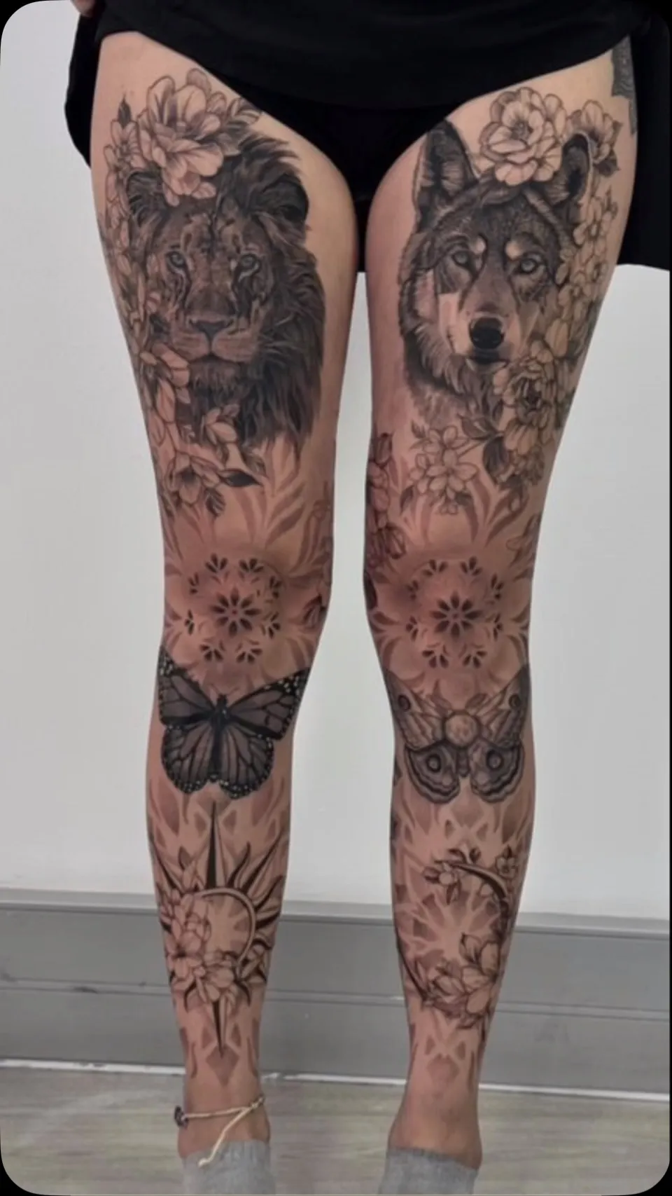 Tatueringsborttagning